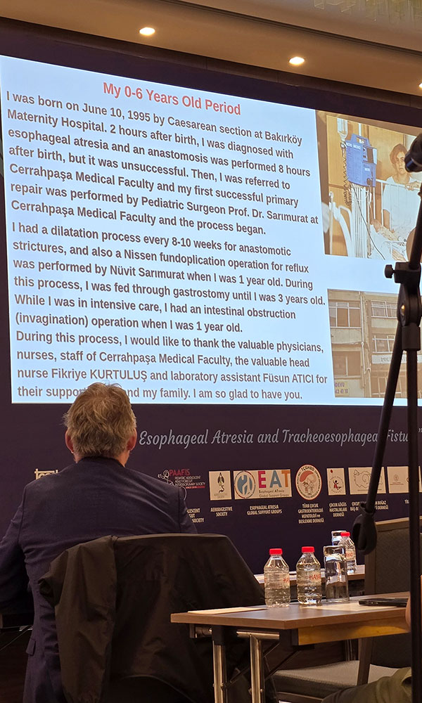 inoea2025, konferencja, atrezja przelyku, stambul