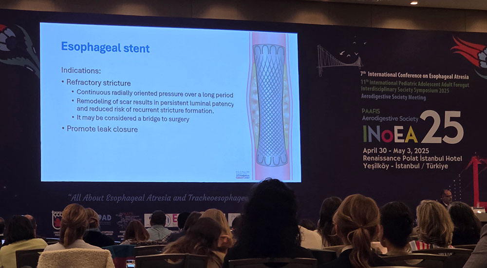 inoea2025, konferencja, atrezja przelyku, stambul